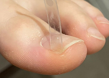 自社開発の器具による安心安全の施術